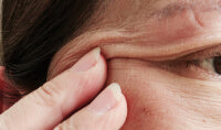 Menopausal skin is caused by the loss of estrogen during this life stage and hormone-sensitive conditions. This hormonal change reduces collagen production and skin hydration, leading to dryness, thinning, and increased sensitivity.